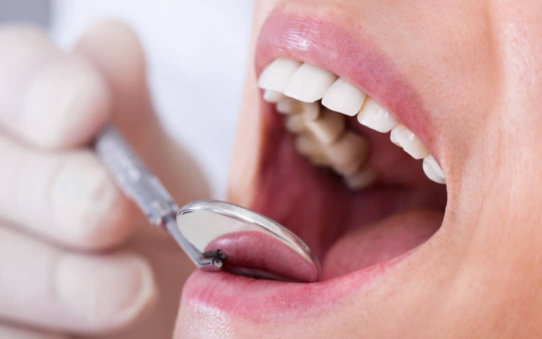 Basic Dental Care (How To Keep Your Mouth Healthy)