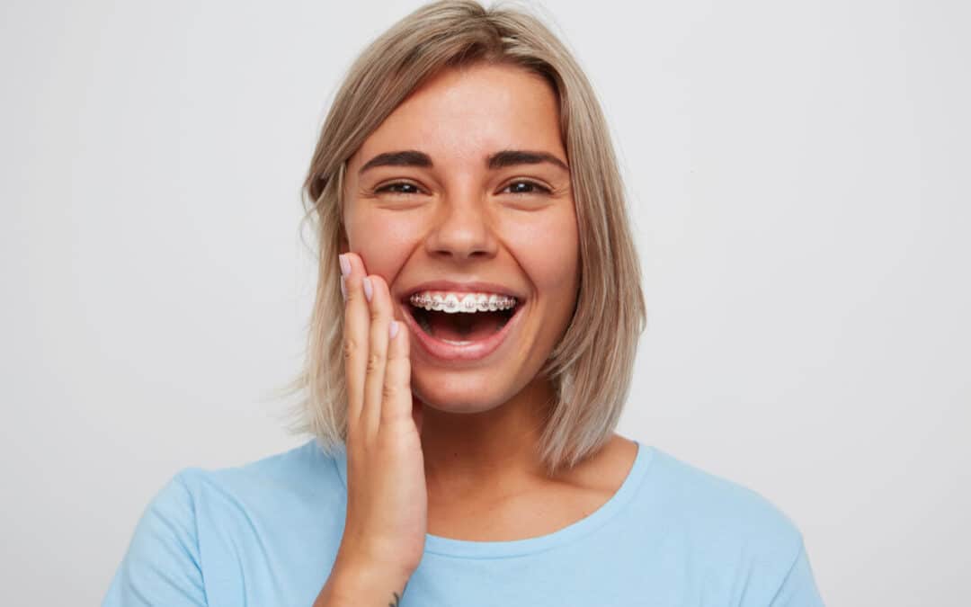 Need To Fix Overcrowded Teeth? (How Metal Braces Fix Teeth Crowding)