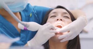 teeth deep cleaning