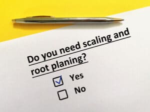 teeth scaling and root planing