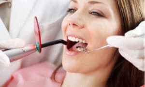 how porcelain dental veneers work